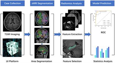 Investigation of Underlying Association Between Whole Brain Regions and Alzheimer’s Disease: A Research Based on an Artificial Intelligence Model